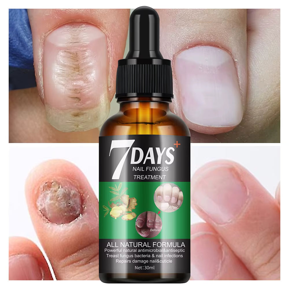✨ 7 DAYS – Endurecedor de Uñas💅 Fortalece, Nutre y Revitaliza tus Uñas