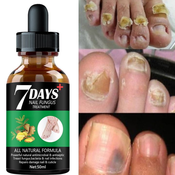 ✨ 7 DAYS – Endurecedor de Uñas💅 Fortalece, Nutre y Revitaliza tus Uñas