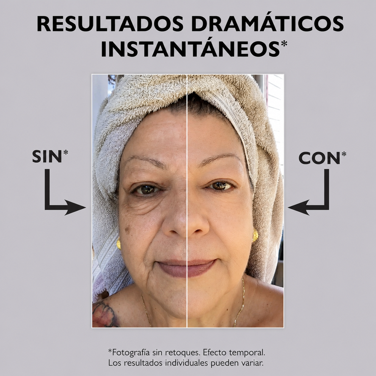 PETER THOMAS ROTH | Adiós Bolsas y Arrugas ✨💎