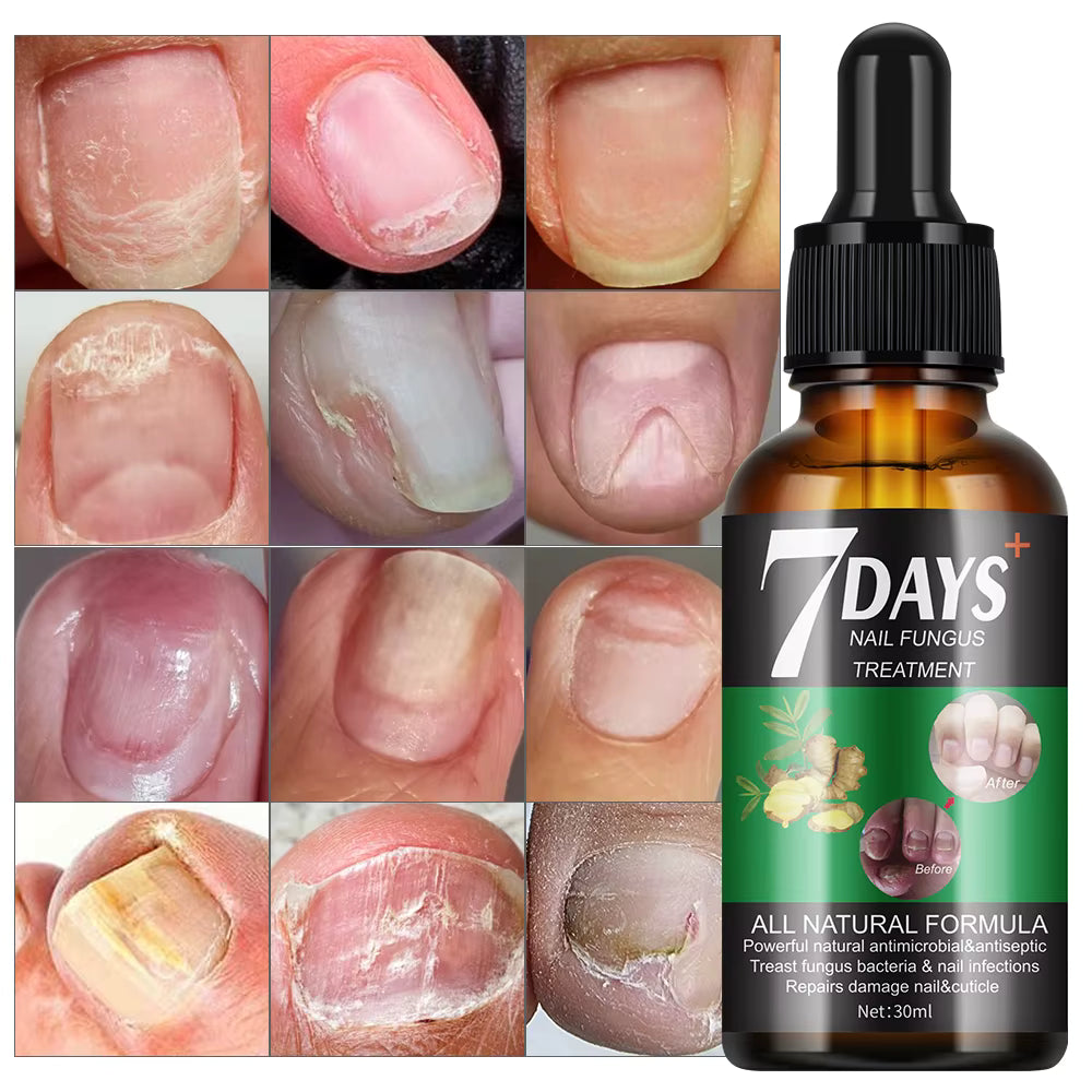 ✨ 7 DAYS – Endurecedor de Uñas💅 Fortalece, Nutre y Revitaliza tus Uñas