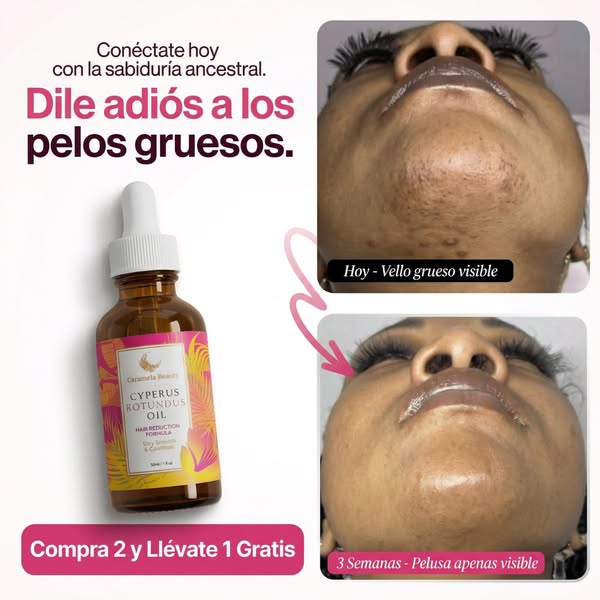 Cyperus Rotundus Oil 30ml: El secreto natural para una piel radiante y sin imperfecciones.