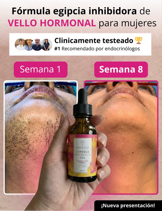 ✨ CYPERUS OIL 30ml – Piel Suave, Sin Vello y Sin Irritación